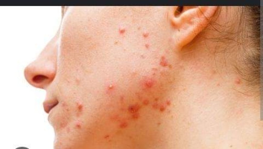 Qozogiston seks 2011 foto video Gig porno civcivlar