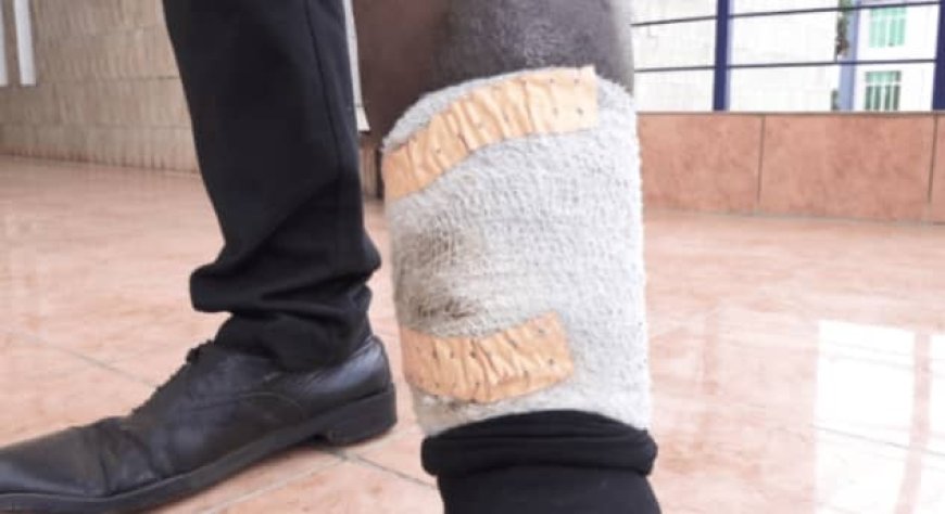 Bibyara kanseri! Icyo inzobere zivuga ku gutindana igikomere (igisebe) ntucyivuze