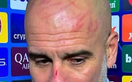 Ukuri ku bikomere byagaragaye mu maso ya Pep Guardiola