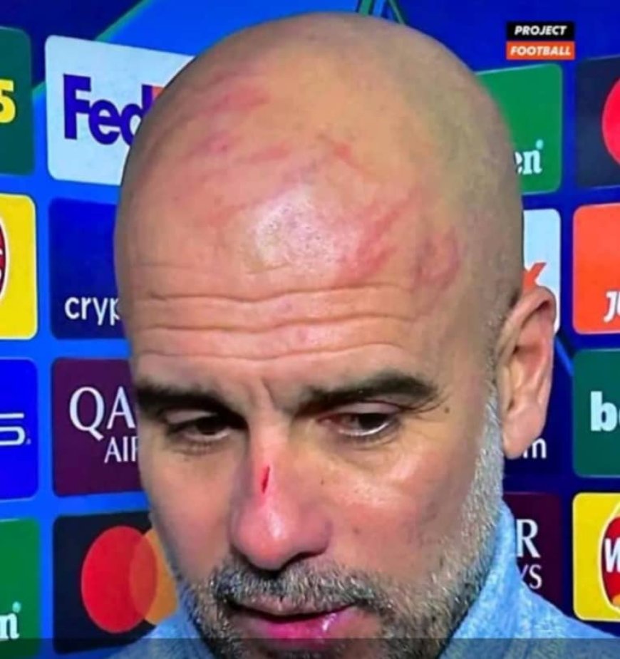 Ukuri ku bikomere byagaragaye mu maso ya Pep Guardiola