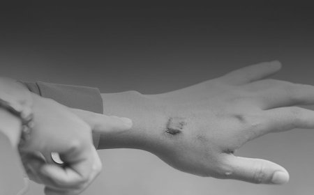 IBANGA RY'UBUZIMA: Igikomere ufite hari umunsi kizaba inkovu