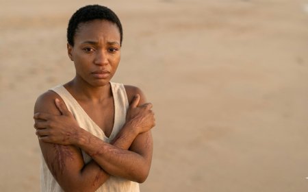 Inkovu ni diplome y’amasomo y’ubuzima: Dore impamvu udakwiye guterwa ipfunwe n’ibikomere ufite.