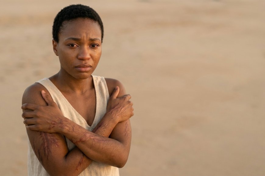 Inkovu ni diplome y’amasomo y’ubuzima: Dore impamvu udakwiye guterwa ipfunwe n’ibikomere ufite.